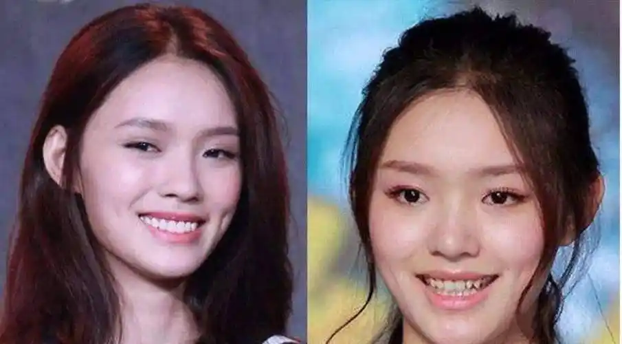 女明星"假牙"大pk,谁的嘴巴闭不上,谁的嘴里藏着一套房?