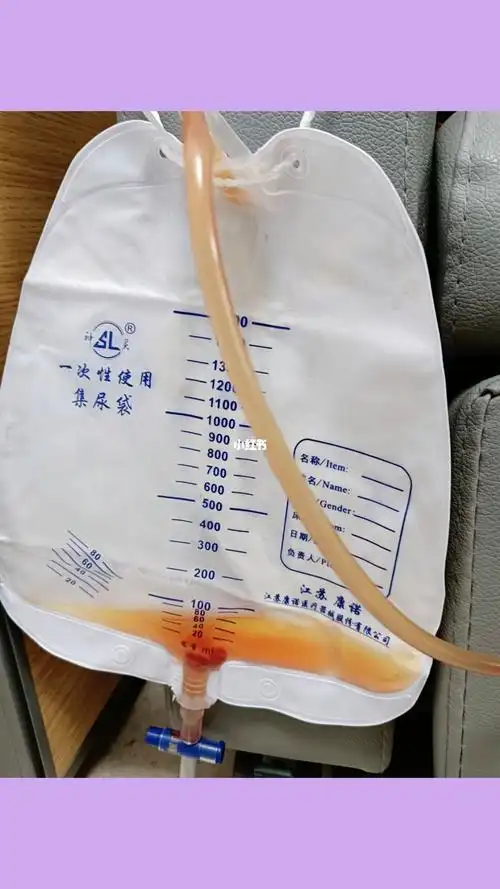 胸腔积液胸腔积水