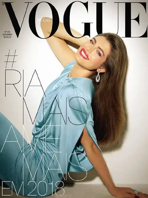 维密迎来首位变形模特 曾遭高管反对