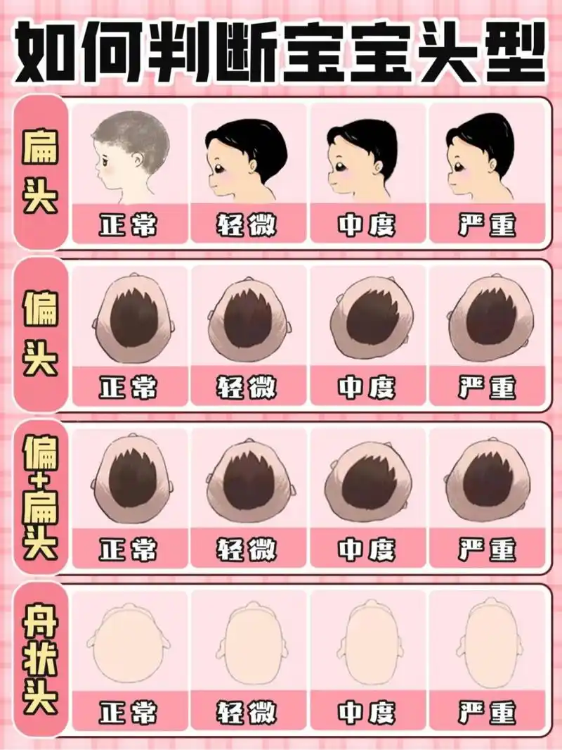 97宝宝头型自查方法: 宝宝头型是否正常,在宝宝洗澡的时候,把头发