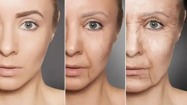 皮肤光老化,皱纹加深如何补救?光子嫩肤术,帮你修复完美的肌肤