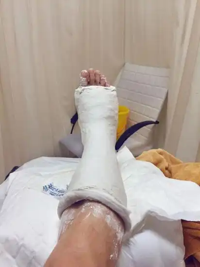 《唐人街探案》再添伤员 马浴柯脚伤骨折