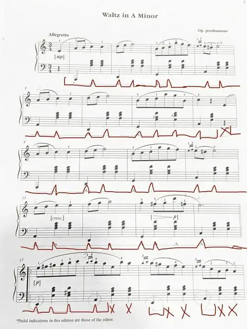 肖邦a小调圆舞曲踏板用法