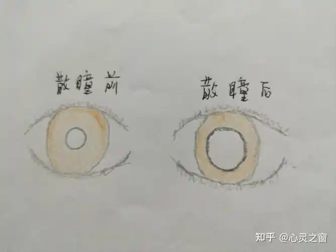 散瞳验光中家长需要注意什么问题?