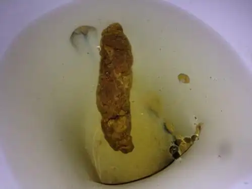 这一年一来大便老是不爽.便秘有时候就拉