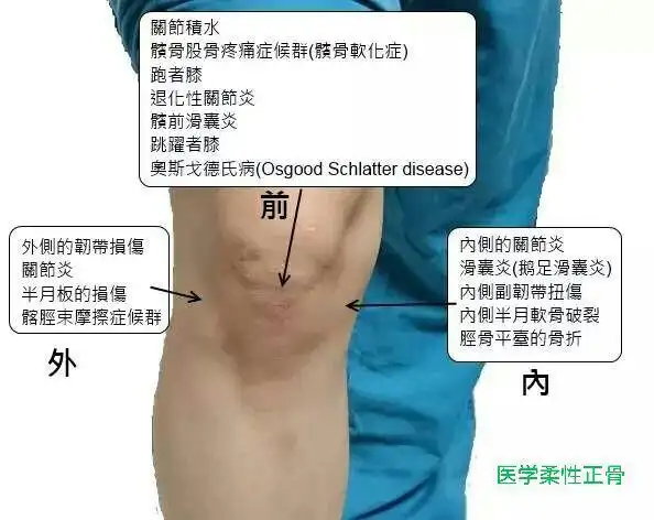 关于膝关节的疼痛