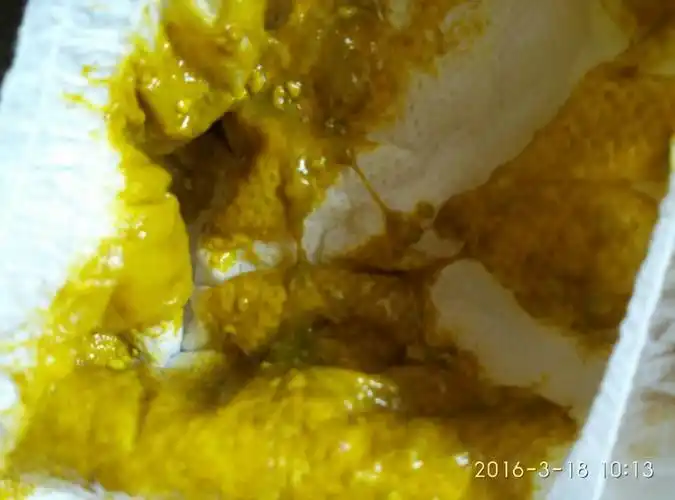 宝宝快四个月了,第一次吃奶粉拉的大便正常吗?