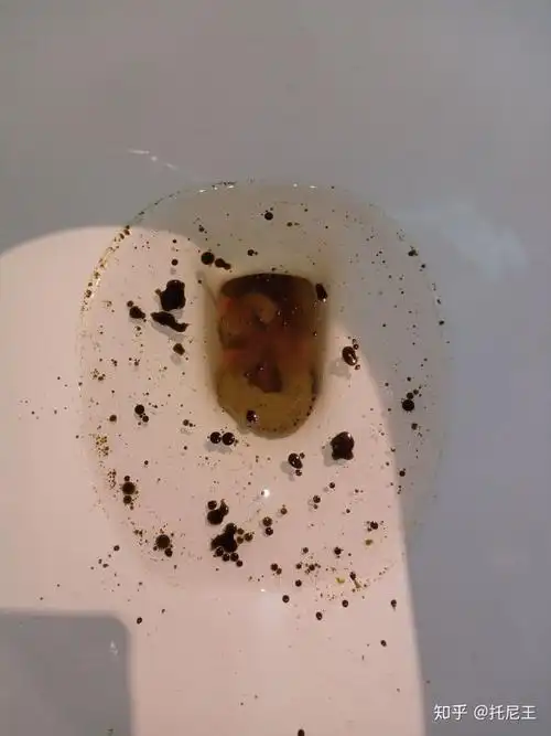 大便颜色:黄色  好多黑油,我也不知道啊