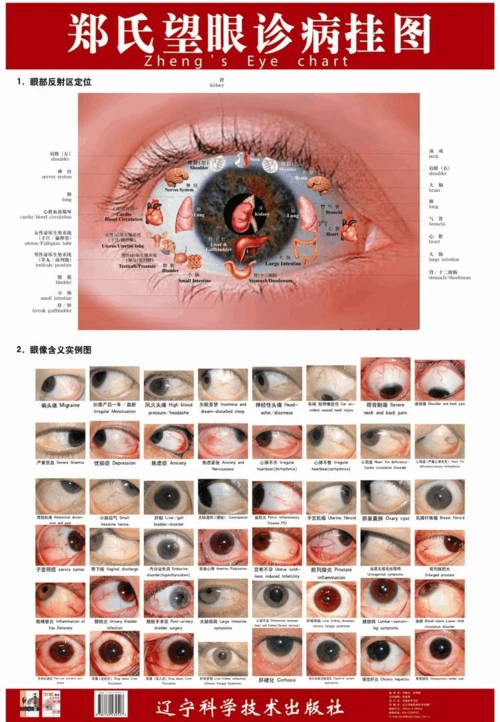 瑶医目诊图-望面诊病图解-目诊