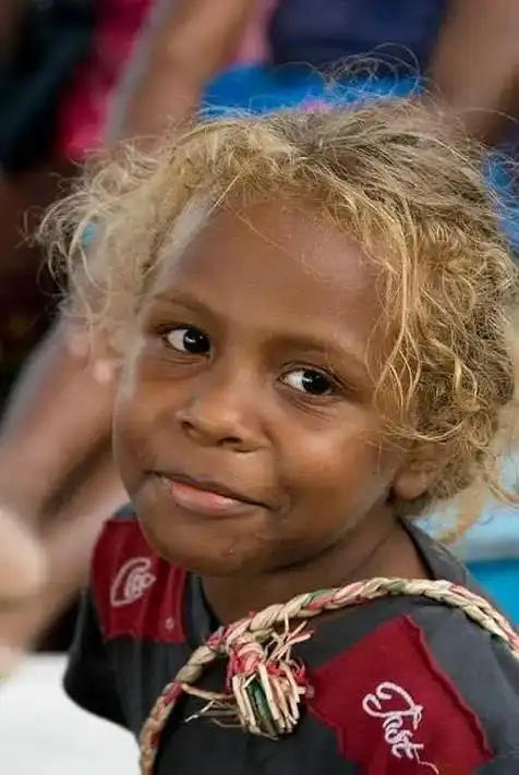 所罗门人是世界上唯一拥有黑皮肤 - 抖音