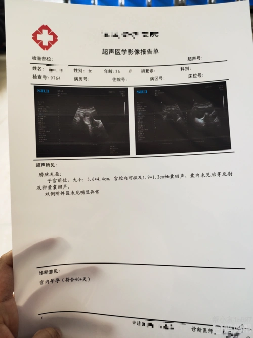 助孕!怀孕45天孕囊大小"哪里便宜"-第1张图片-途临网