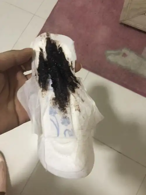 本人21岁吃了很多月经不调的药,现在可是越来越严重了,大姨妈少黑请问