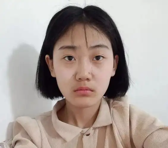 一张无偏角,露额头和耳朵的正脸照有需要的姑娘,可以给我们发两张