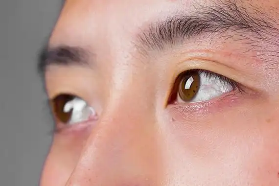 眼睛白眼球发黄怎么办,如何保护眼睛