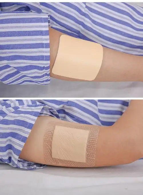 赛肤康瑞褥疮贴压疮贴自粘聚氨酯泡沫敷料医用无菌硅凝胶伤口敷料溃疡