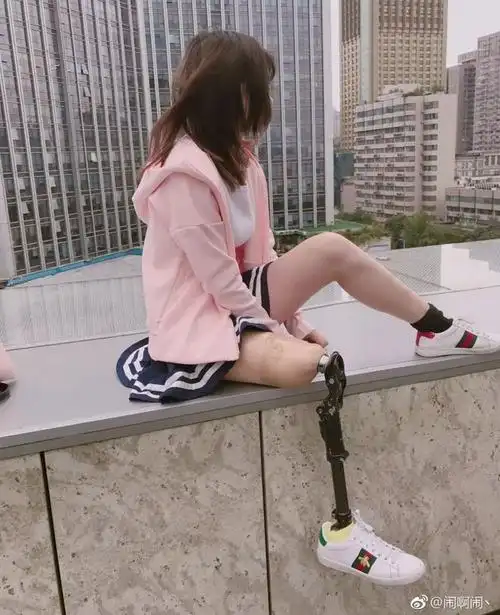 95后独腿女孩自闭2年健身游泳走出阴影练出马甲线