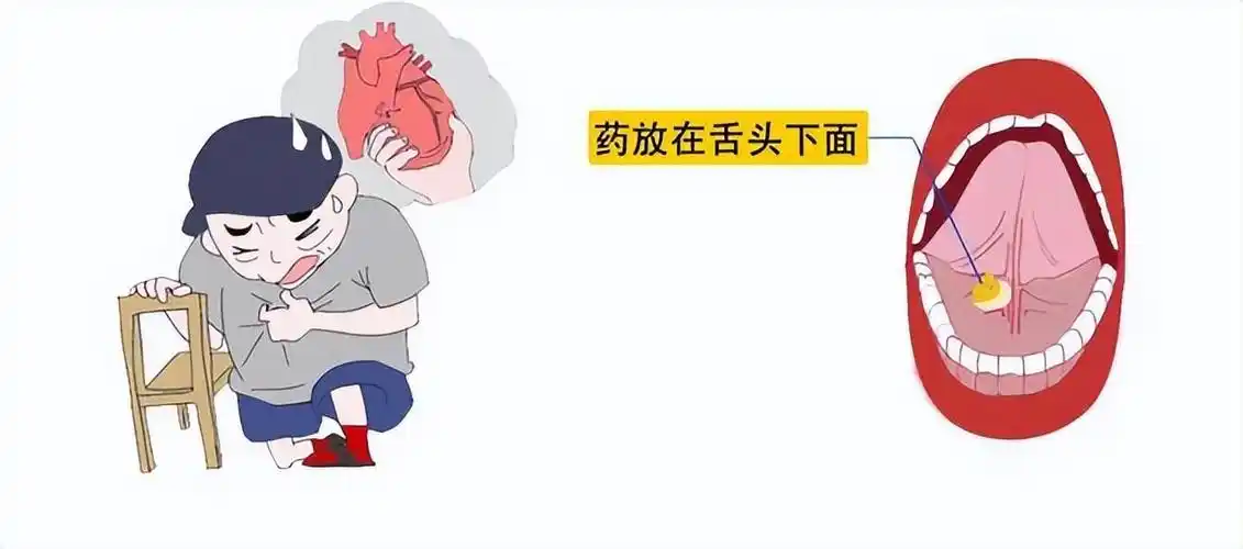 使用速效救心丸"救心"救命,应注意这几点!
