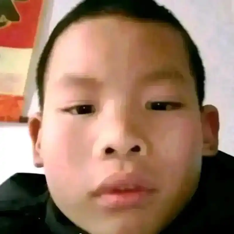 肿瘤哥头像 #侵权即删  - 抖音