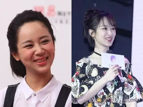 杨紫天生牙齿问题并不大,没有出现严重层次不齐的状况,只是牙齿大小上
