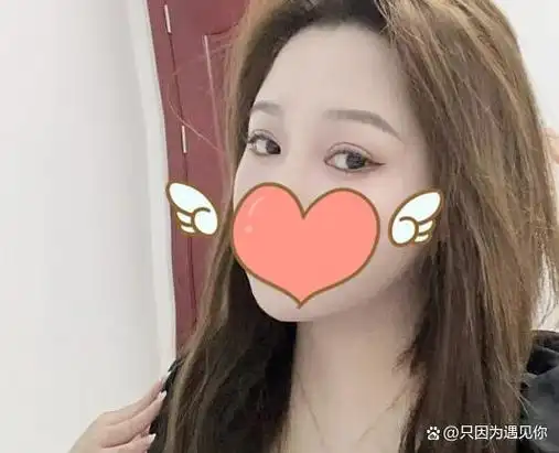 开扇双眼皮效果图|亲测体验细节一览