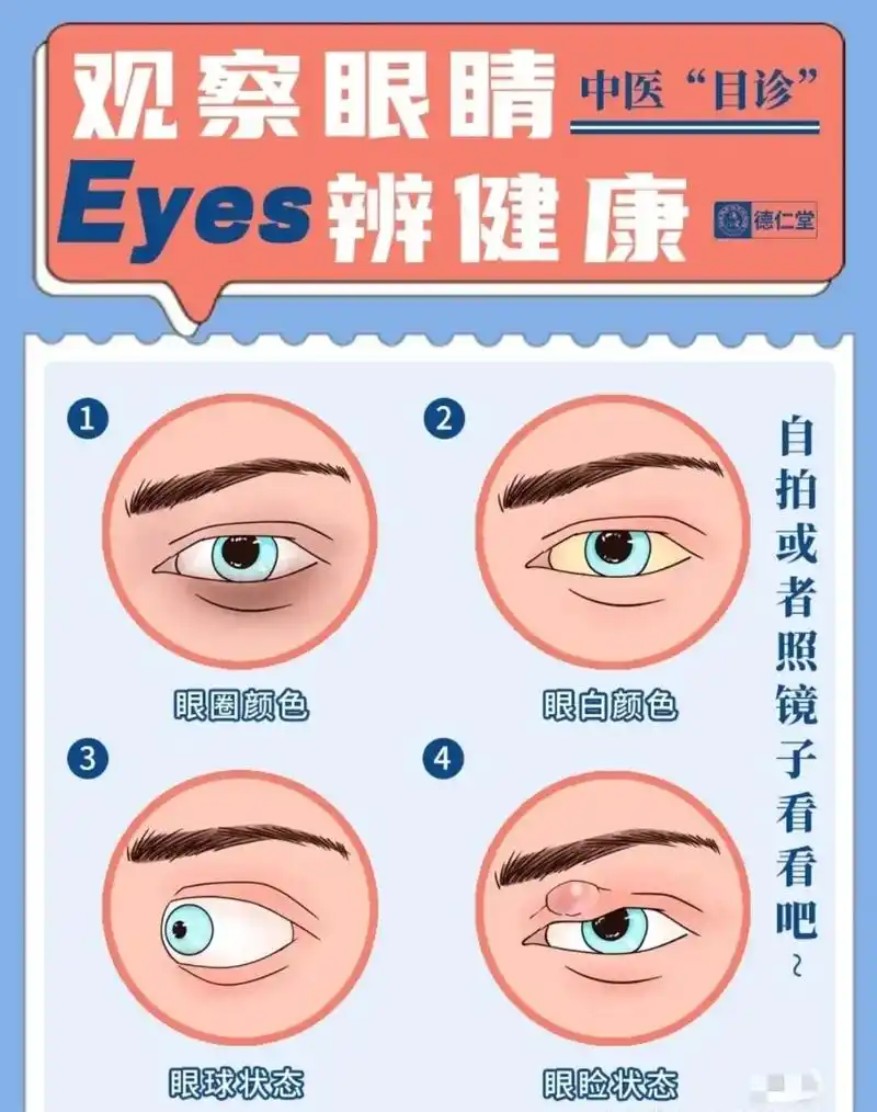 老中医教你看眼睛98辨健康|预防大小病,未病 - 抖音