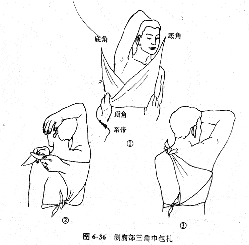 将燕尾式三角巾的夹角正对伤侧腋窝,双手持燕尾式底边的两端,紧压在