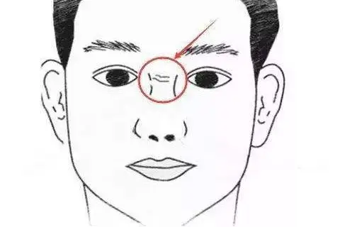详解鼻梁上有横纹的面相好坏