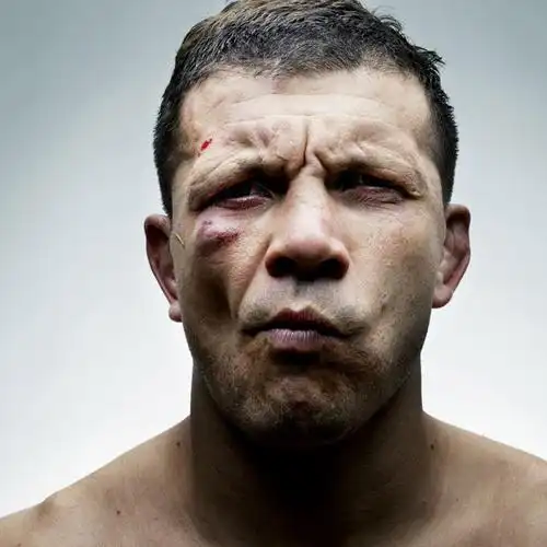 有伤痕的男人才性感:以图为证!