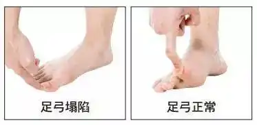 如果走路时脚掌控制出现问题,跑步也会出现问题.