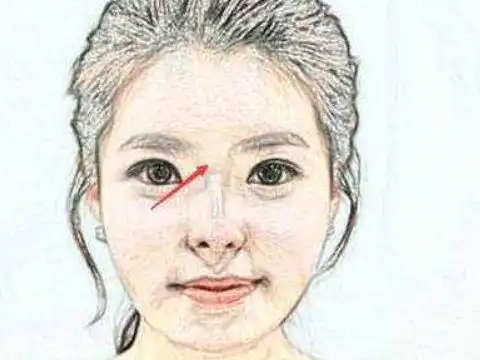 注定此生穷命女人面相:下巴尖小虽然在现代社会上,很多的女人都会追求