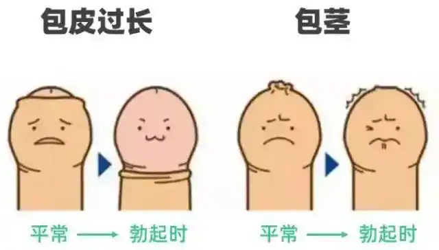 宝宝的小丁丁勃起玩弄小丁丁是性早熟吗