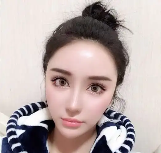 打过玻尿酸的美女一眼就知!3个特征,泄露整容秘密!