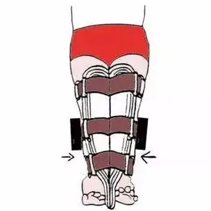 必知!"o"型腿及"x"型腿矫正方法总结