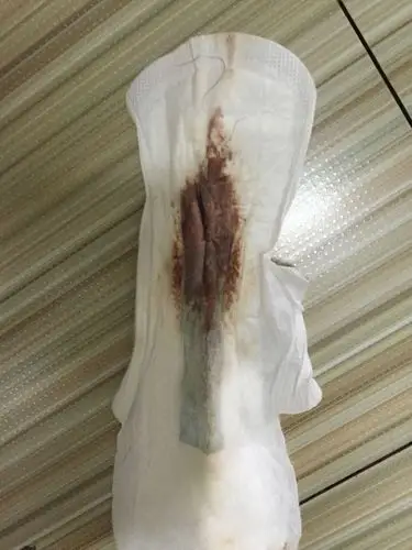 月经来了两天总共就这点量,是什么情况啊?_百度宝宝知道