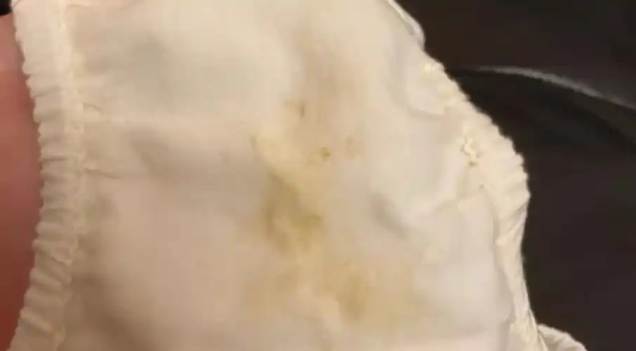 正常白带图片是什么样(女宝内裤上有黄色分泌物) - 赤虎壹号