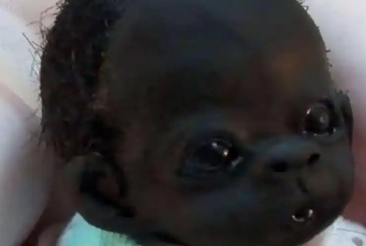 前几年,在非洲就诞生了一个被誉为全球最黑宝宝的小孩,当时这件事轰动