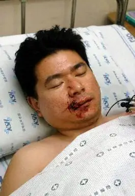 图国航空难幸存者机长吴新禄在医院休养