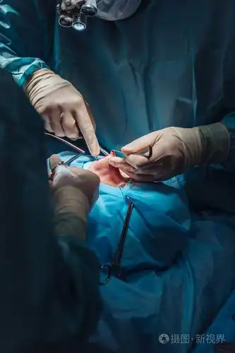 鼻子上的整容手术.外科医生割肉