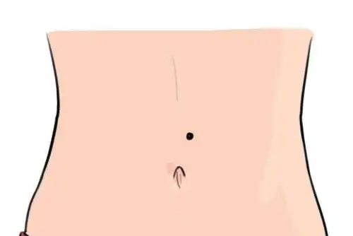 这个部位有痣代表"星",听者有星,偏财犹如满天星斗!_女人