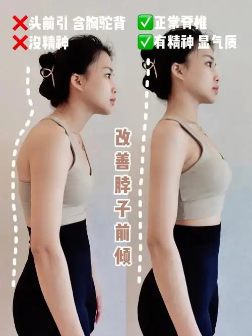 矫正脖子前倾 | 6招养成好体态 为气质加分