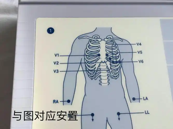 其它 心电图机的使用――肝病三四科 1,v1导联是把探查电极放在胸骨右