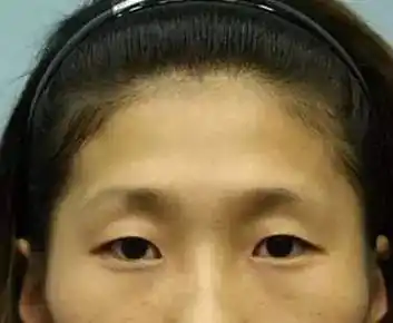 额头窄小眼睛适合什么发型_额头窄小适合什么短发_额头窄小