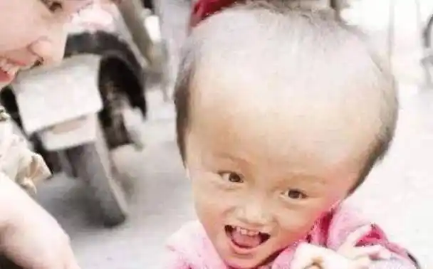 湖南多名婴儿,喝假奶粉成大头娃娃,引发关注商家为什么要这么做