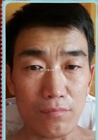 面相图片额头有横纹的男人面相女人额头有纹面相分析印堂凸起男人面相