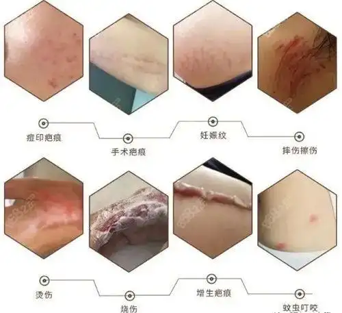 贵阳疤痕修复医院排名已更新贵州利美康仍稳居榜单前三