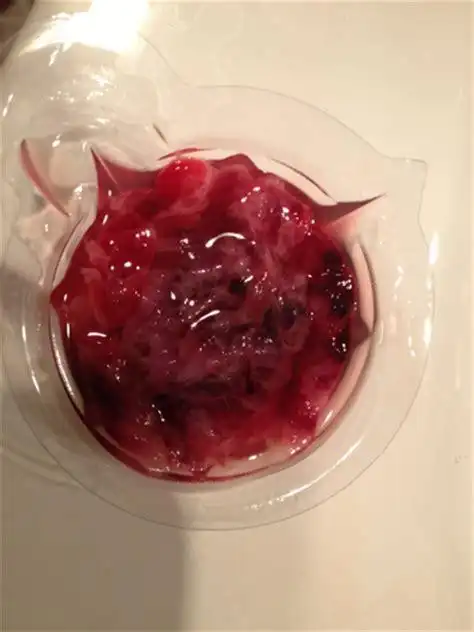 流产下来的孕囊是圆的