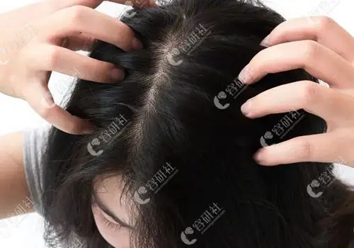 扁平,凹陷的头顶