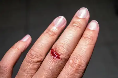 血糖仪,血糖值是在手指上测量的女性手指上的血氧计.晴朗的秋日.