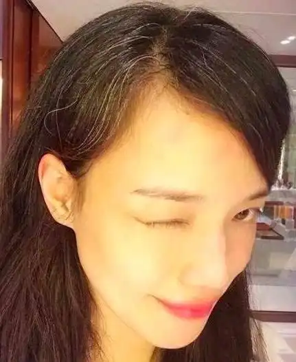 她曾靠一脱成名,如今满头白发让人心疼,才41岁提前进入老年期