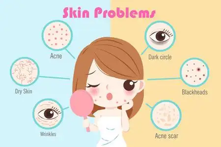 面部皮肤问题卡通女人有皮肤问题白色背景油性皮肤问题妇女女人的皮肤
